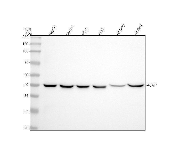 m02008 acat1 primary antibodies wb testing 1