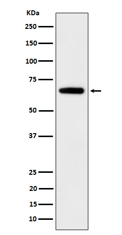 Western blot analysis of IGF2BP2 expression in 293T cell lysate