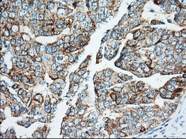 m02010 anti igf2bp2 mouse monoclonal antibody clone id oti3f9 ihc testing 4