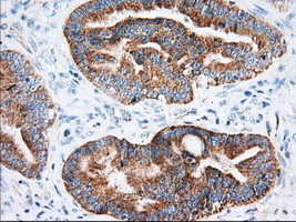 m02010 anti igf2bp2 mouse monoclonal antibody clone id oti3f9 ihc testing 6
