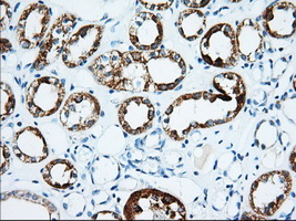 m02010 anti igf2bp2 mouse monoclonal antibody clone id oti3f9 ihc testing 7