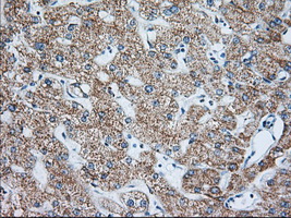 m02010 anti igf2bp2 mouse monoclonal antibody clone id oti3f9 ihc testing 8