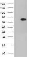 HEK293T cells were transfected with the pCMV6-ENTRY control (Left lane) or pCMV6-ENTRY IGF2BP2 (Right lane) cDNA for 48 hrs and lysed