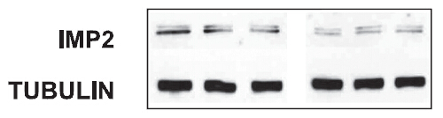 Figure from citation: Western Blot of IGF2BP2 (IMP2) protein level by using anti-IGF2BP2 antibody in rat glomerular MCs