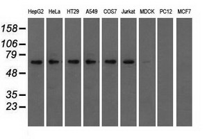 Western blot analysis of extracts (35ug) from 9 different cell lines by using anti-IGF2BP2 monoclonal antibody