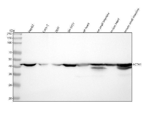  Western blot analysis of ACTA1 using anti-ACTA1 antibody (M02014-1)