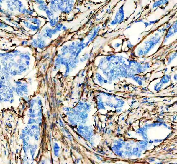 IHC analysis of Actin (Alpha-Actin) using anti-Actin (Alpha-Actin) antibody (M02014-4)