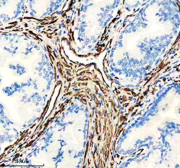 IHC analysis of Actin (Alpha-Actin) using anti-Actin (Alpha-Actin) antibody (M02014-4)