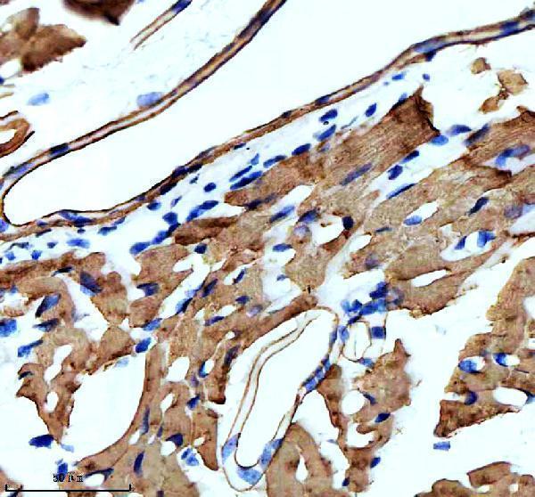 IHC analysis of Actin (Alpha-Actin) using anti-Actin (Alpha-Actin) antibody (M02014-4)