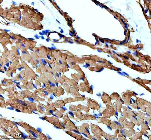 m02014 4 acta1 primary antibodies ihc testing 4
