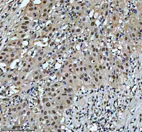 IHC analysis of NUMA using anti-NUMA antibody (M02018-1)