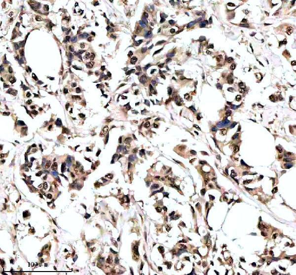 IHC analysis of NUMA using anti-NUMA antibody (M02018-1)