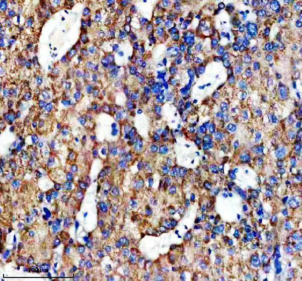 IHC analysis of PCK1 using anti-PCK1 antibody (M02022-1)