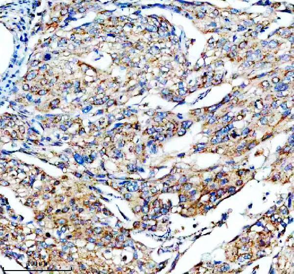 IHC analysis of PCK1 using anti-PCK1 antibody (M02022-1)
