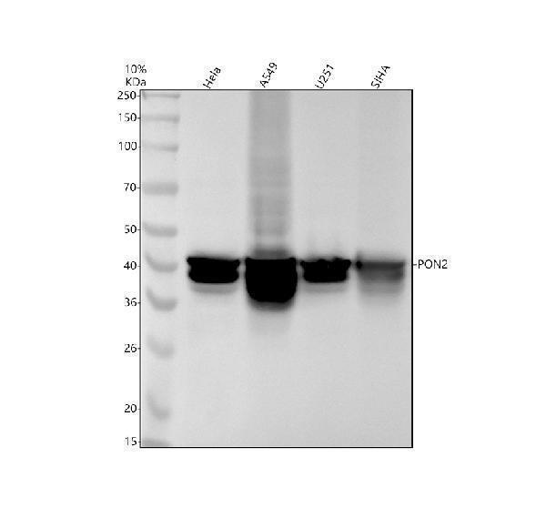 Western blot analysis of PON2 using anti-PON2 antibody (M02027-1)
