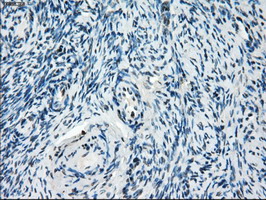 m02028 1 anti tristetraprolin zfp36 mouse monoclonal antibody clone id oti8b5 ihc testing 3