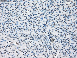 m02028 1 anti tristetraprolin zfp36 mouse monoclonal antibody clone id oti8b5 ihc testing 4