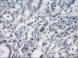 m02028 1 anti tristetraprolin zfp36 mouse monoclonal antibody clone id oti8b5 ihc testing 7