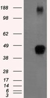 m02028 1 anti tristetraprolin zfp36 mouse monoclonal antibody clone id oti8b5 wb testing 1