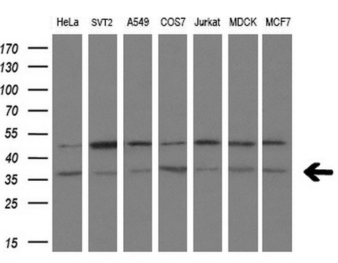 m02028 1 anti tristetraprolin zfp36 mouse monoclonal antibody clone id oti8b5 wb testing 2