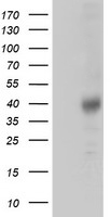 m02028 anti tristetraprolin zfp36 mouse monoclonal antibody clone id oti1a2 wb testing 1