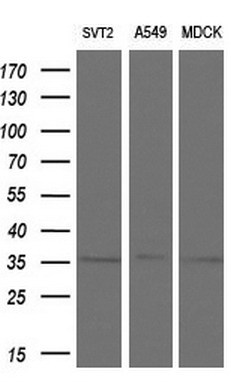 m02028 anti tristetraprolin zfp36 mouse monoclonal antibody clone id oti1a2 wb testing 2