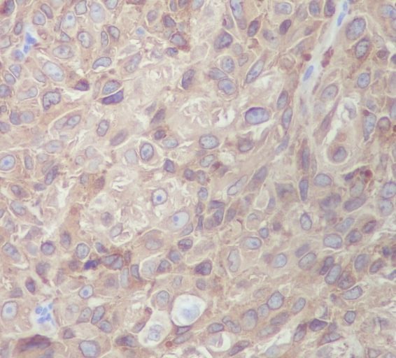 m02033 1 ihc