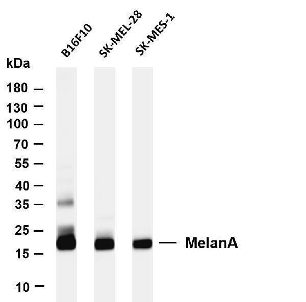 Various whole cell lysates were separated by 4-20% SDS-PAGE, and the membrane was blotted with anti-MelanA antibody