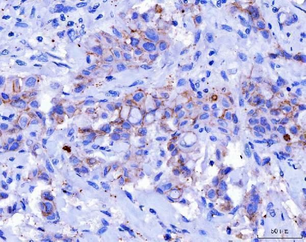  IHC analysis of Desmoglein 2/DSG2 using anti-Desmoglein 2/DSG2 antibody (M02035-2)