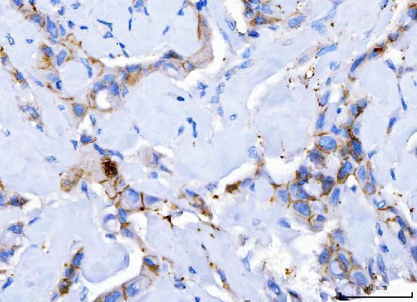  IHC analysis of Desmoglein 2/DSG2 using anti-Desmoglein 2/DSG2 antibody (M02035-2)