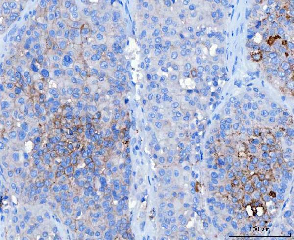 m02035 2 dsg2 primary antibodies ihc testing 4