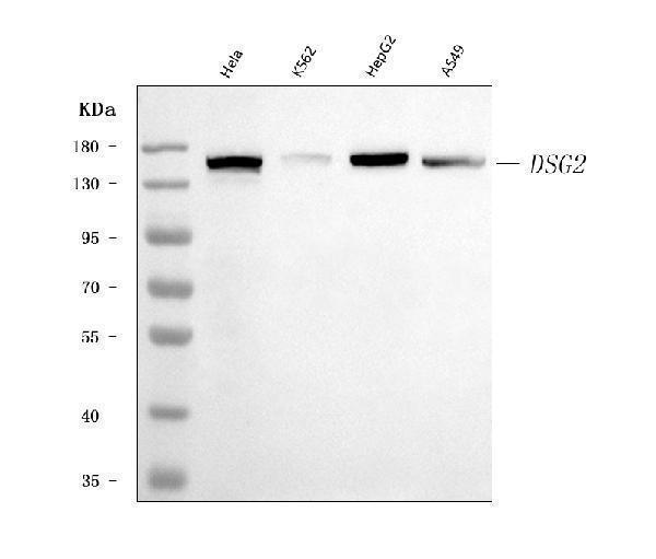  Western blot analysis of Desmoglein 2/DSG2 using anti-Desmoglein 2/DSG2 antibody (M02035-2)