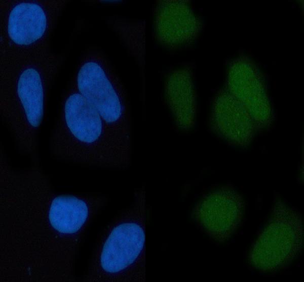 m02038 c jun primary antibodies if testing 2