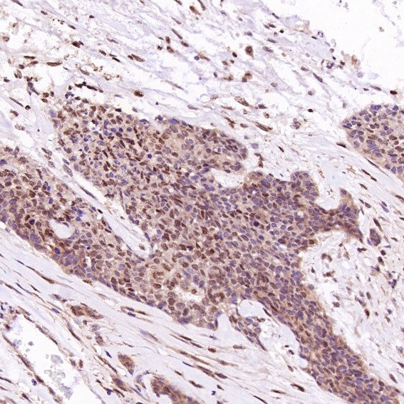 m02038 ihc10