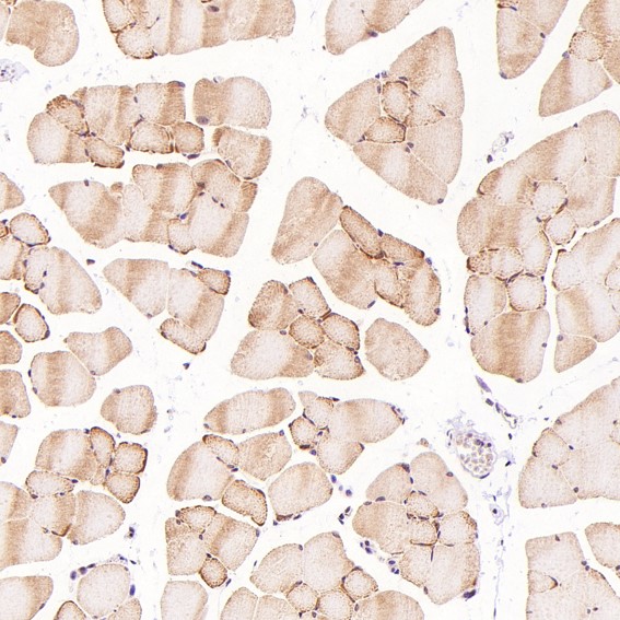 m02038 ihc11