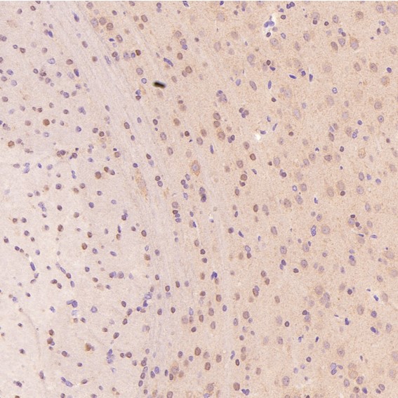 m02038 ihc7