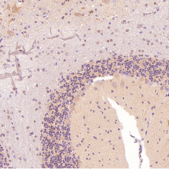 m02038 ihc8