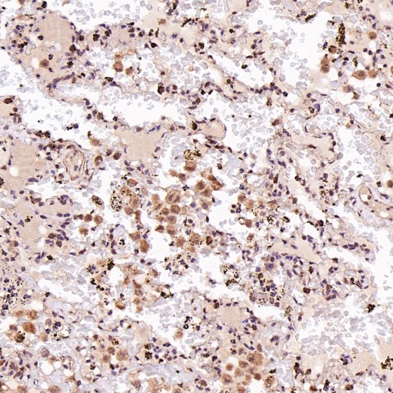 m02038 ihc9
