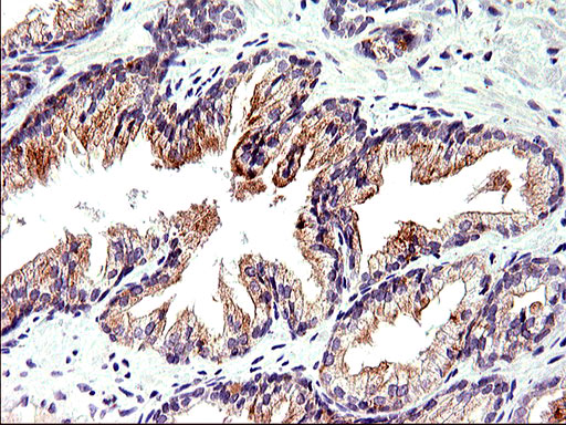Immunohistochemical staining of paraffin-embedded Human prostate tissue within the normal limits using anti-TOLLIP mouse monoclonal antibody