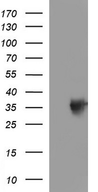 HEK293T cells were transfected with the pCMV6-ENTRY control (Left lane) or pCMV6-ENTRY TOLLIP (Right lane) cDNA for 48 hrs and lysed