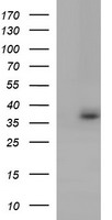 HEK293T cells were transfected with the pCMV6-ENTRY control (Left lane) or pCMV6-ENTRY TOLLIP (Right lane) cDNA for 48 hrs and lysed