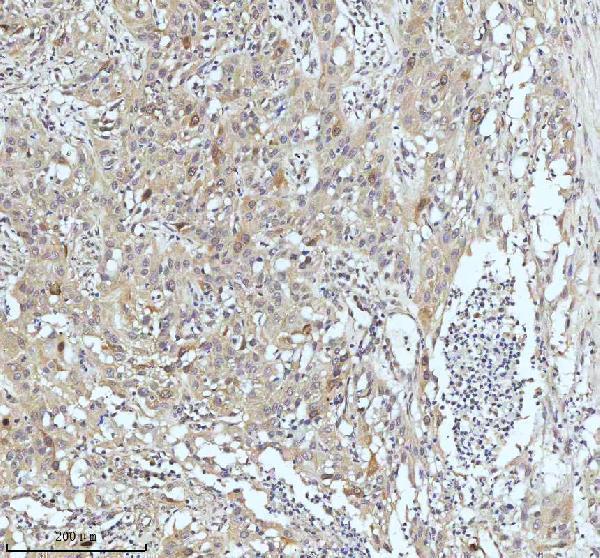 m02040 ccnb2 primary antibodies ihc testing 10