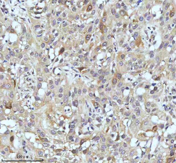 m02040 ccnb2 primary antibodies ihc testing 11