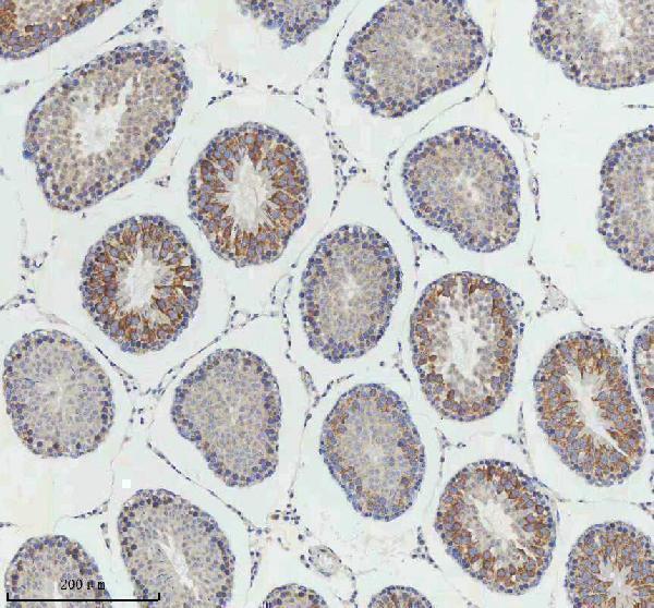 m02040 ccnb2 primary antibodies ihc testing 12