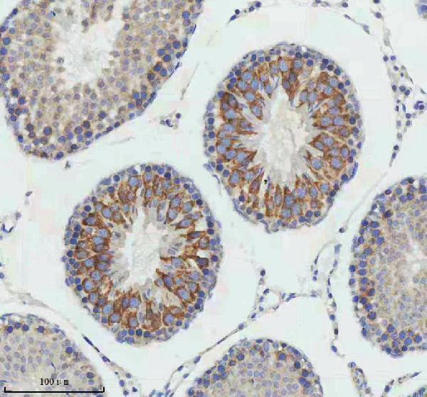 m02040 ccnb2 primary antibodies ihc testing 13