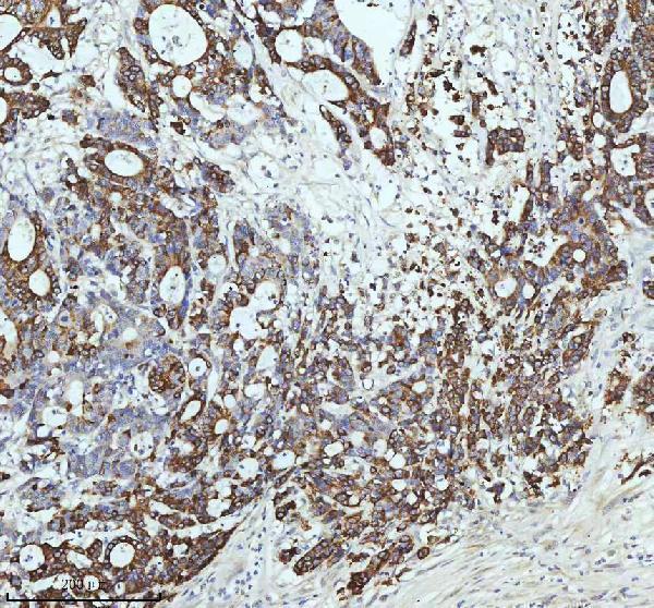  IHC analysis of CCNB2 using anti-CCNB2 antibody (M02040)