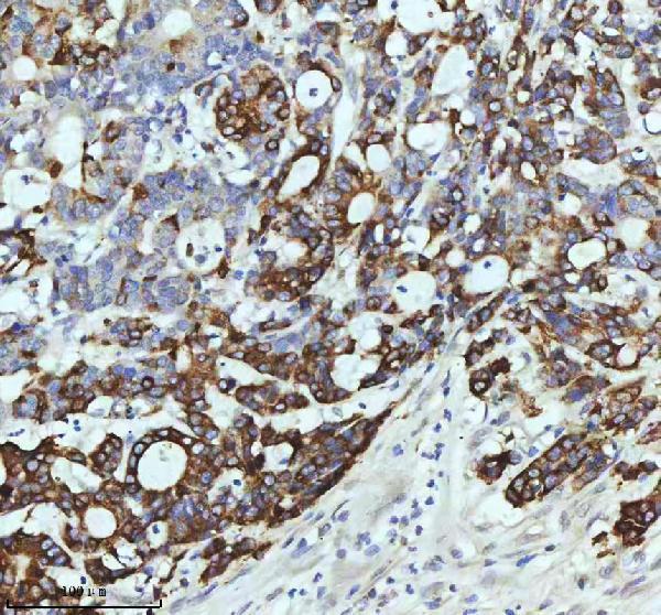  IHC analysis of CCNB2 using anti-CCNB2 antibody (M02040)