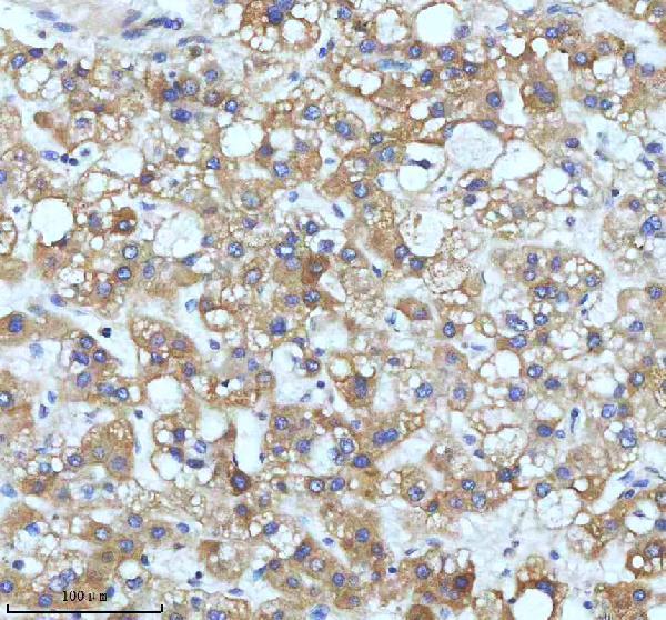 m02040 ccnb2 primary antibodies ihc testing 5