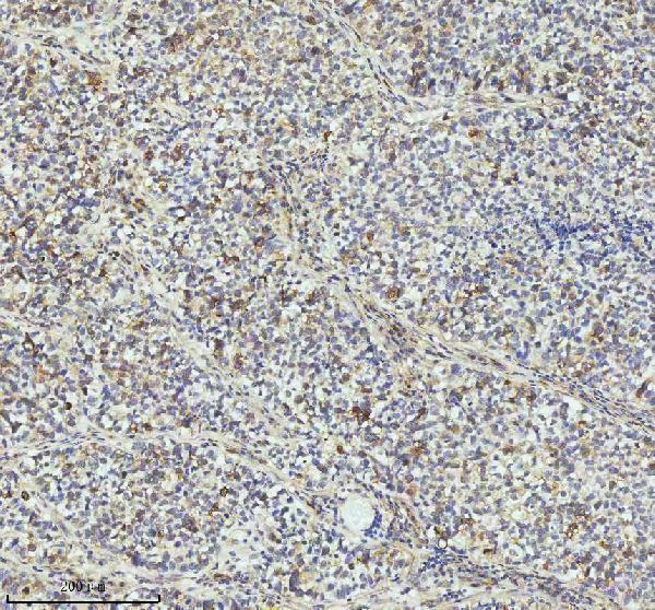 m02040 ccnb2 primary antibodies ihc testing 6