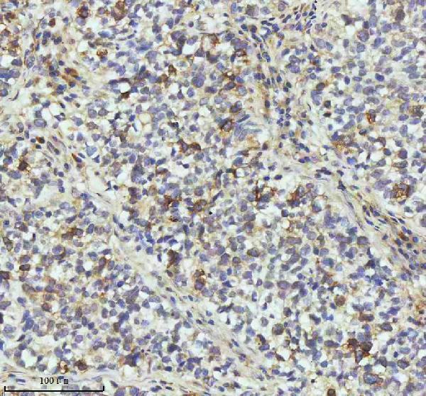 m02040 ccnb2 primary antibodies ihc testing 7
